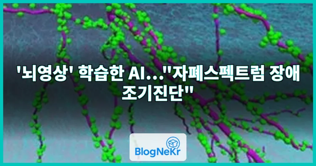 '뇌영상' 학습한 AI…"자폐스펙트럼 장애 조기진단" 관련 이미지