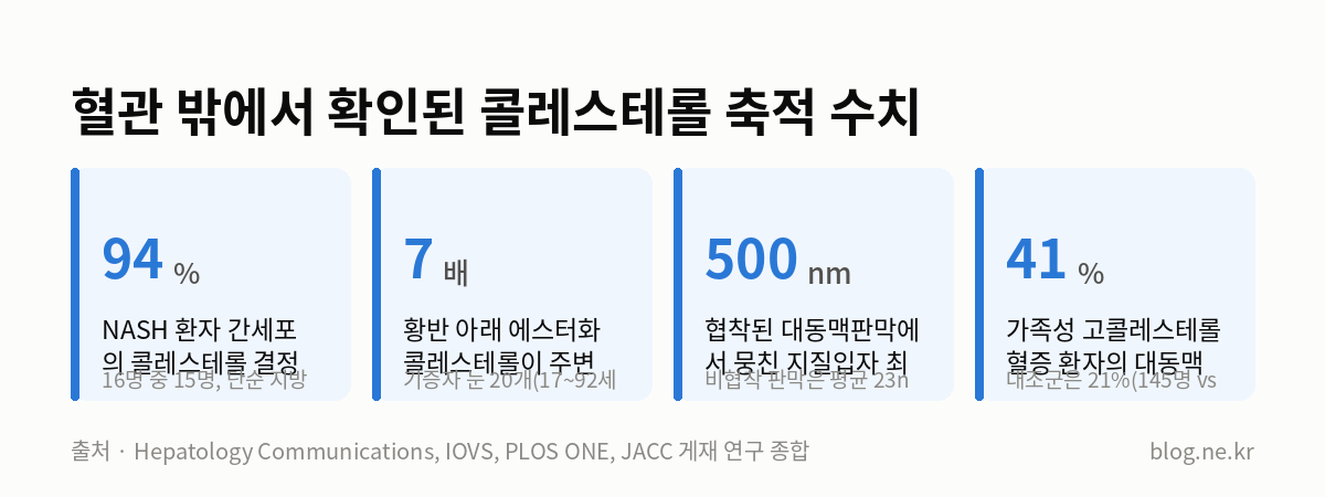 혈관 밖에서 확인된 콜레스테롤 축적 수치 인포그래픽