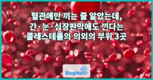혈관에만 끼는 줄 알았는데, 간·눈·심장판막에도 낀다는 콜레스테롤의 의외의 부위 3곳